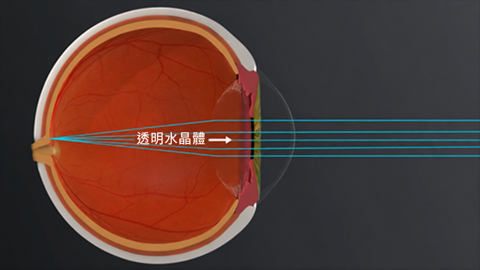 透明的水晶體讓光線通過並聚焦。